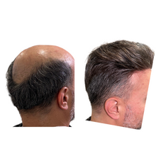 Load image into Gallery viewer, Sistemas Capilares en 3 pagos